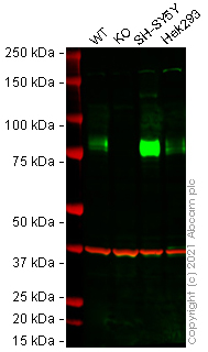 Western blot - Anti-LIMPII antibody [EPR12080] (AB176317), expandable thumbnail