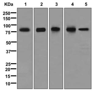 Western blot - Anti-LIMPII antibody [EPR12080] (AB176317), expandable thumbnail
