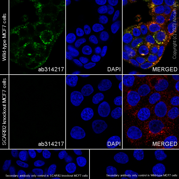 Immunocytochemistry/ Immunofluorescence - Anti-LIMPII antibody [EPR26243-125] (AB314217)