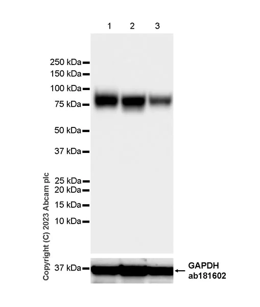 Western blot - Anti-LIMPII antibody [EPR26243-125] (AB314217)