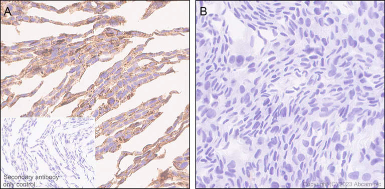 Immunohistochemistry (Formalin/PFA-fixed paraffin-embedded sections) - Anti-LIMPII antibody [EPR26243-125] - BSA and Azide free (AB314218)
