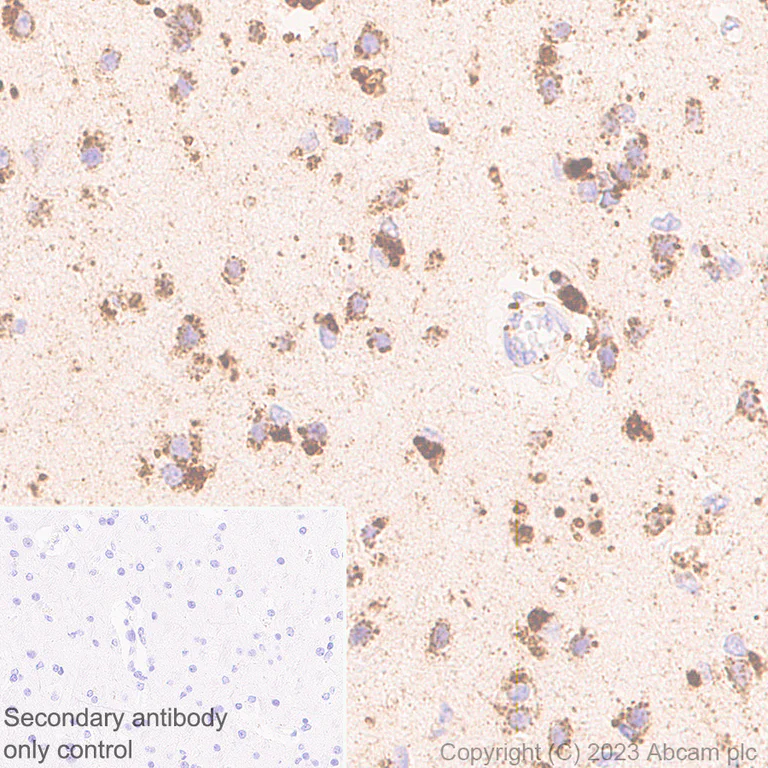 Immunohistochemistry (Formalin/PFA-fixed paraffin-embedded sections) - Anti-LIMPII antibody [EPR26243-125] - BSA and Azide free (AB314218)