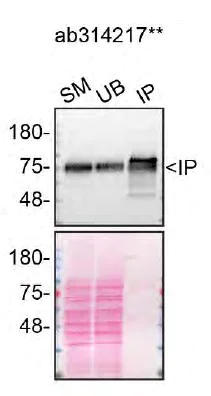 Immunoprecipitation - Anti-LIMPII antibody [EPR26243-125] - BSA and Azide free (AB314218)