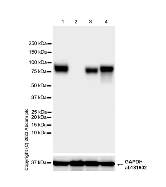 Western blot - Anti-LIMPII antibody [EPR26243-125] - BSA and Azide free (AB314218)
