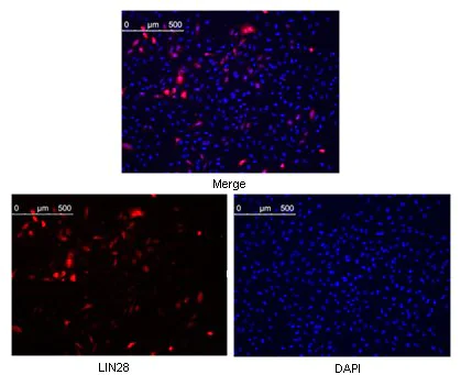 Immunocytochemistry/ Immunofluorescence - Anti-Lin28A antibody [6D1F9] (AB76369)