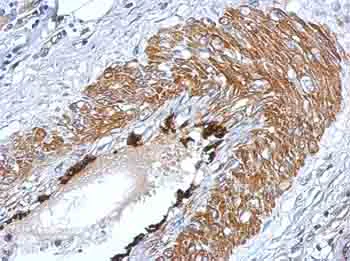 Immunohistochemistry (Formalin/PFA-fixed paraffin-embedded sections) - Anti-Lin28A antibody (AB155542)