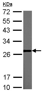 Western blot - Anti-Lin28A antibody (AB155542), expandable thumbnail