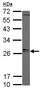 Western blot - Anti-Lin28A antibody (AB155542)