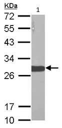 Western blot - Anti-Lin28A antibody (AB155542)