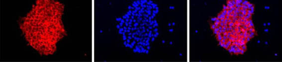 Immunocytochemistry/ Immunofluorescence - Anti-Lin28A antibody (AB175352)