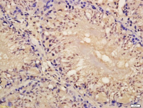 Immunohistochemistry (Formalin/PFA-fixed paraffin-embedded sections) - Anti-Lin28A antibody (AB218028)