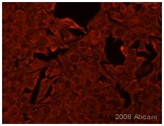 Immunocytochemistry/ Immunofluorescence - Anti-Lin28A antibody (AB46020)