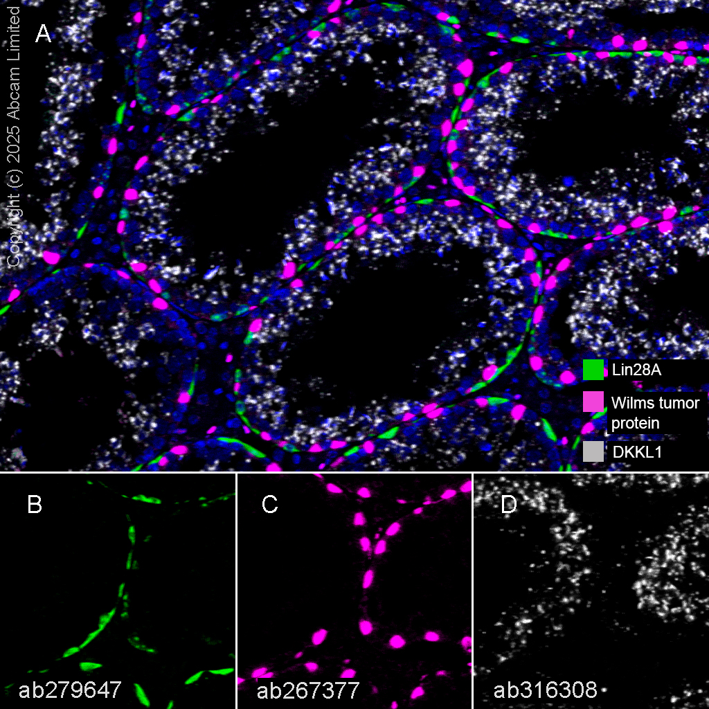 Multiplex immunohistochemistry - Anti-Lin28A antibody [EPR24286-100] (AB279647)