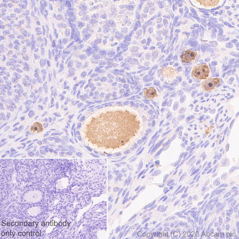 Immunohistochemistry (Formalin/PFA-fixed paraffin-embedded sections) - Anti-Lin28A antibody [EPR24286-100] - BSA and Azide free (AB279650)
