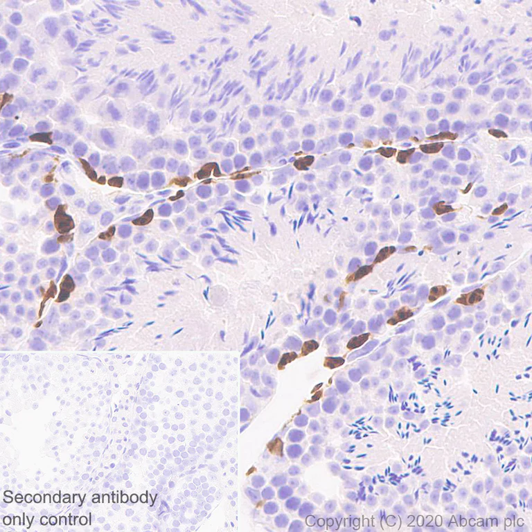 Immunohistochemistry (Formalin/PFA-fixed paraffin-embedded sections) - Anti-Lin28A antibody [EPR24286-100] - BSA and Azide free (AB279650)