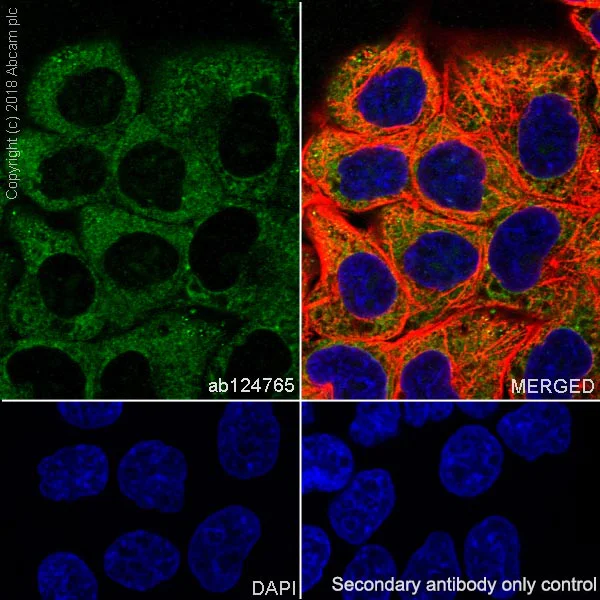 Immunocytochemistry/ Immunofluorescence - Anti-Lin28A antibody [EPR4640] (AB124765)