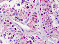 Immunohistochemistry (Formalin/PFA-fixed paraffin-embedded sections) - Anti-Lin28B antibody (AB115698), expandable thumbnail