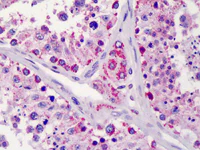 Immunohistochemistry (Formalin/PFA-fixed paraffin-embedded sections) - Anti-Lin28B antibody (AB115698)