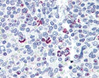 Immunohistochemistry (Formalin/PFA-fixed paraffin-embedded sections) - Anti-Lin28B antibody (AB115698), expandable thumbnail