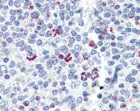 Immunohistochemistry (Formalin/PFA-fixed paraffin-embedded sections) - Anti-Lin28B antibody (AB115698)