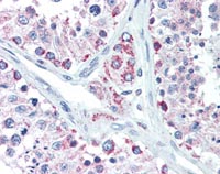 Immunohistochemistry (Formalin/PFA-fixed paraffin-embedded sections) - Anti-Lin28B antibody (AB115698), expandable thumbnail