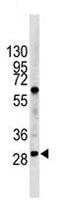 Western blot - Anti-Lin28B antibody (AB115698), expandable thumbnail