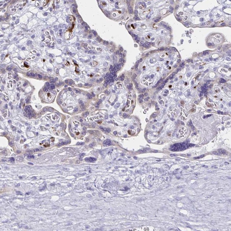 Immunohistochemistry (Formalin/PFA-fixed paraffin-embedded sections) - Anti-Lin28B antibody (AB262858)