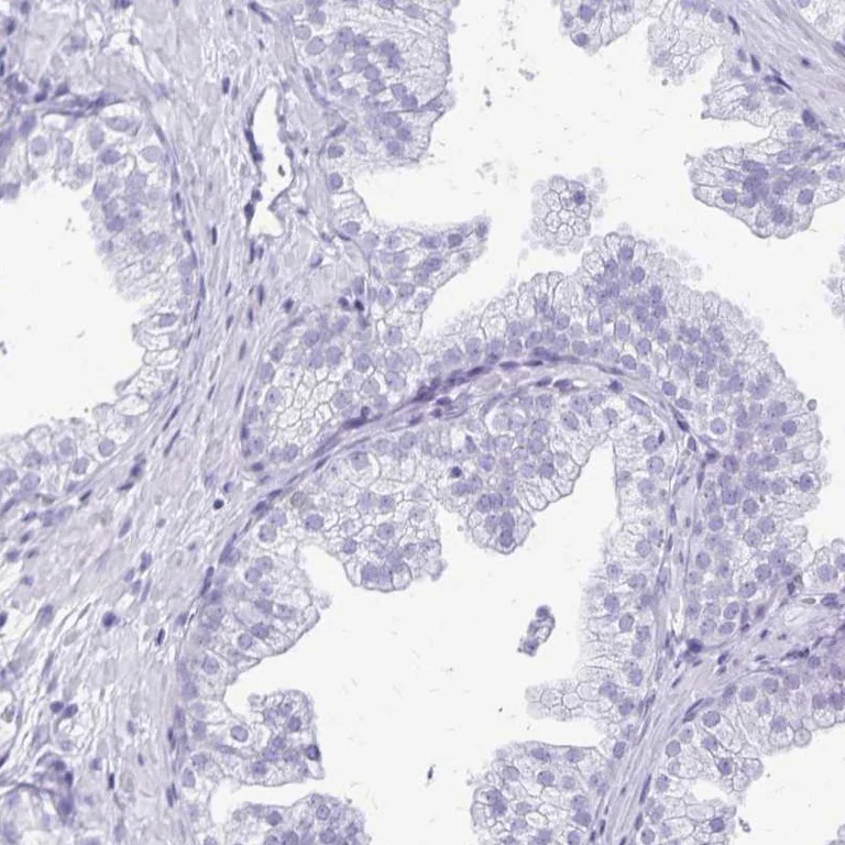 Immunohistochemistry (Formalin/PFA-fixed paraffin-embedded sections) - Anti-Lin28B antibody (AB262859)