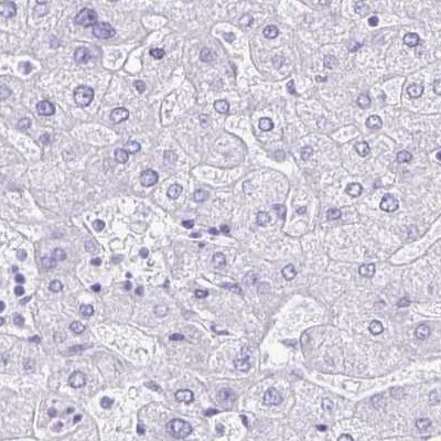 Immunohistochemistry (Formalin/PFA-fixed paraffin-embedded sections) - Anti-Lin28B antibody (AB262859)