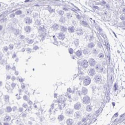 Immunohistochemistry (Formalin/PFA-fixed paraffin-embedded sections) - Anti-Lin28B antibody (AB262859)