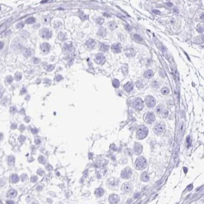 Immunohistochemistry (Formalin/PFA-fixed paraffin-embedded sections) - Anti-Lin28B antibody (AB262859)