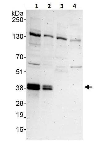 Western blot - Anti-Lin28B antibody (AB264333)