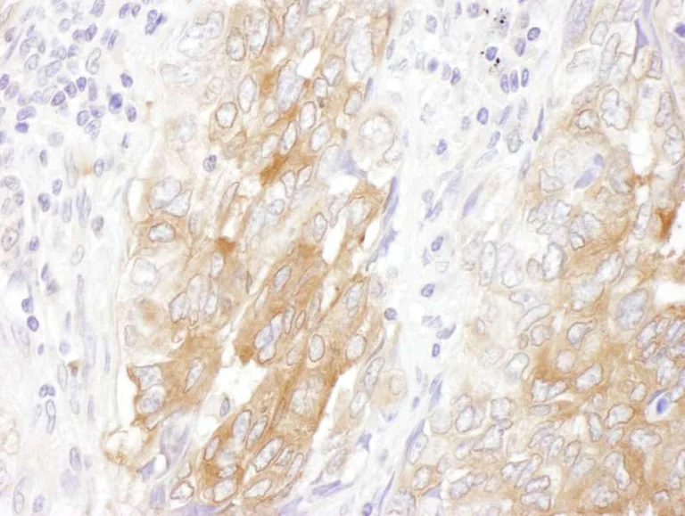 Immunohistochemistry (Formalin/PFA-fixed paraffin-embedded sections) - Anti-Lin28B antibody (AB264334)