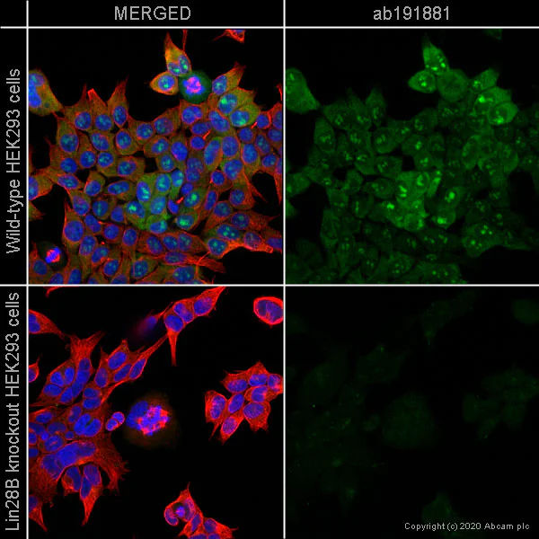 Immunocytochemistry/ Immunofluorescence - Anti-Lin28B antibody [EPR18717] (AB191881)