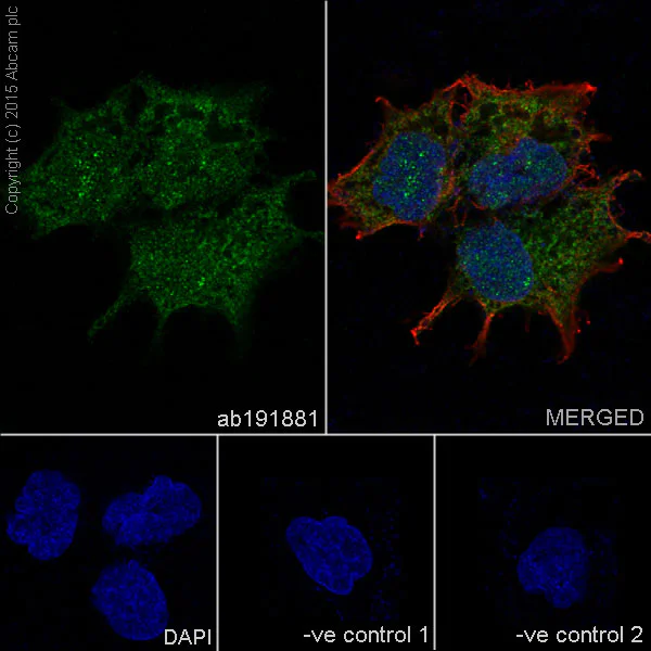 Immunocytochemistry/ Immunofluorescence - Anti-Lin28B antibody [EPR18717] - BSA and Azide free (AB240326)