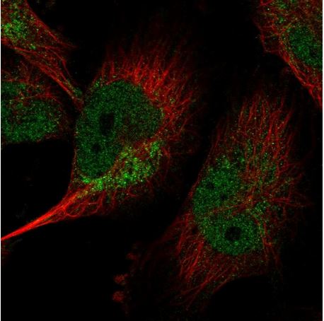 Immunocytochemistry/ Immunofluorescence - Anti-LIN37 antibody (AB184973)