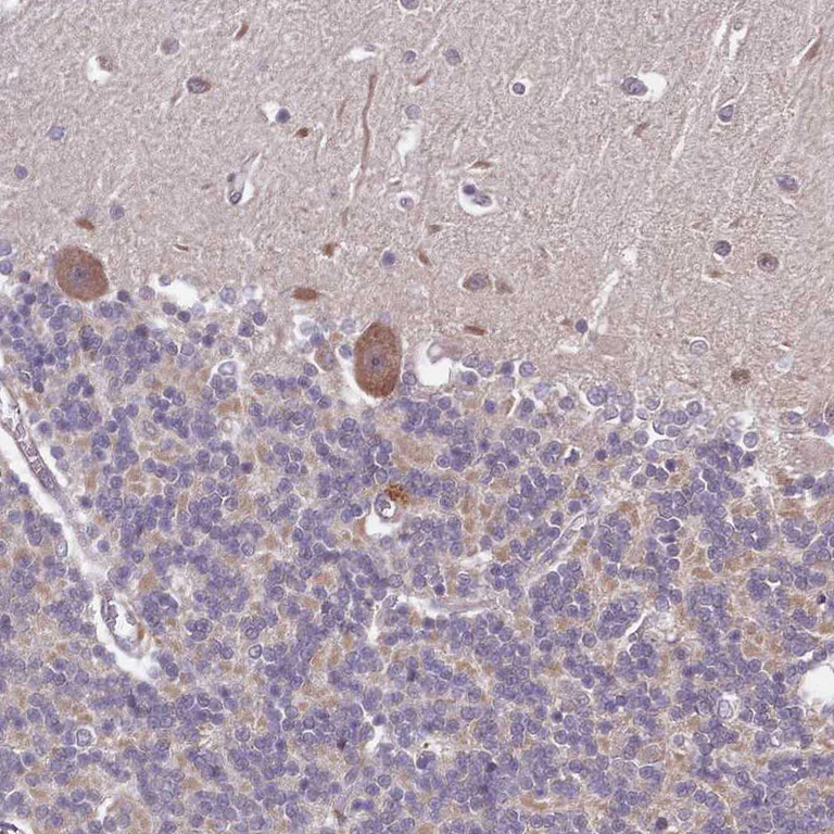 Immunohistochemistry (Formalin/PFA-fixed paraffin-embedded sections) - Anti-LIN37 antibody (AB184973)