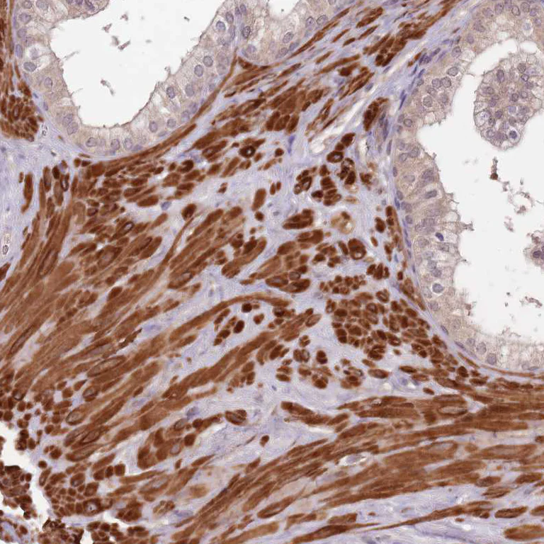 Immunohistochemistry (Formalin/PFA-fixed paraffin-embedded sections) - Anti-LIN37 antibody (AB184973)