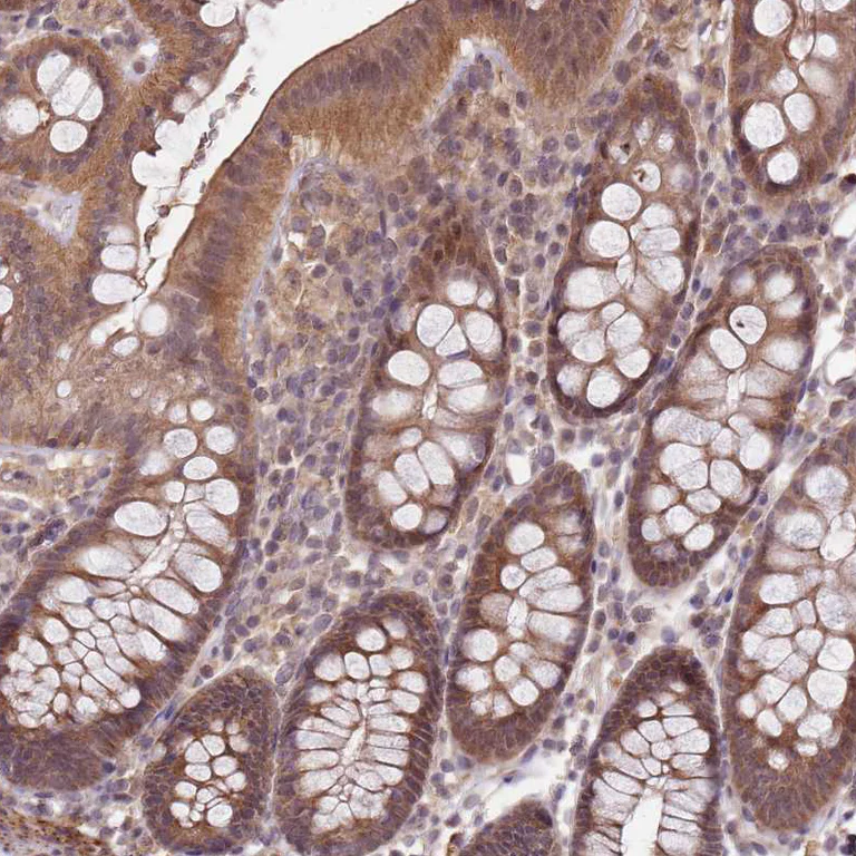 Immunohistochemistry (Formalin/PFA-fixed paraffin-embedded sections) - Anti-LIN37 antibody (AB184973)