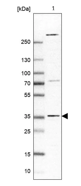 Western blot - Anti-LIN37 antibody (AB184973)