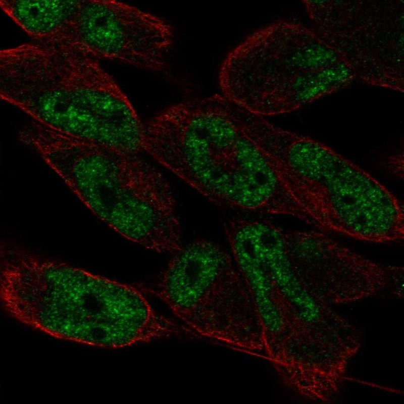 Immunocytochemistry/ Immunofluorescence - Anti-LIN52 antibody (AB262931), expandable thumbnail
