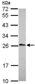 Western blot - Anti-LIN7 antibody (AB127049)