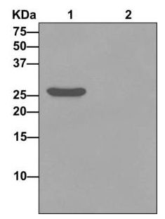 Immunoprecipitation - Anti-LIN7A antibody [EPR12609] (AB174297), expandable thumbnail