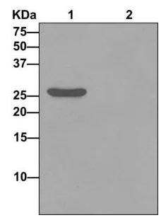 Immunoprecipitation - Anti-LIN7A antibody [EPR12609] (AB174297)