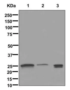 Western blot - Anti-LIN7A antibody [EPR12609] (AB174297)