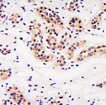 Immunohistochemistry (Formalin/PFA-fixed paraffin-embedded sections) - Anti-LIN9/TGS antibody (AB214230)