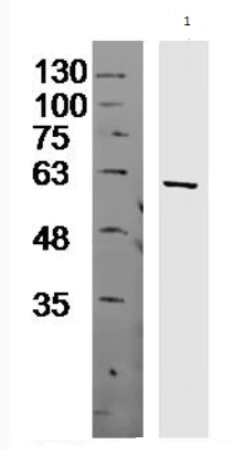 Western blot - Anti-LIN9/TGS antibody (AB214230)