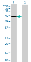 Western blot - Anti-LIN9/TGS antibody (AB71887)