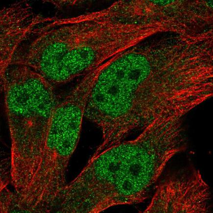 Immunocytochemistry/ Immunofluorescence - Anti-LINC00493 antibody (AB223169), expandable thumbnail
