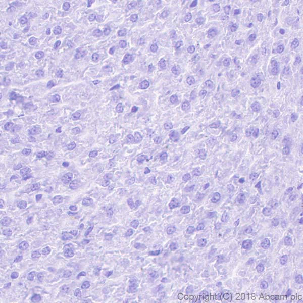 Immunohistochemistry (Formalin/PFA-fixed paraffin-embedded sections) - Anti-LINE-1 ORF1p antibody [EPR21844-108] (AB216324), expandable thumbnail